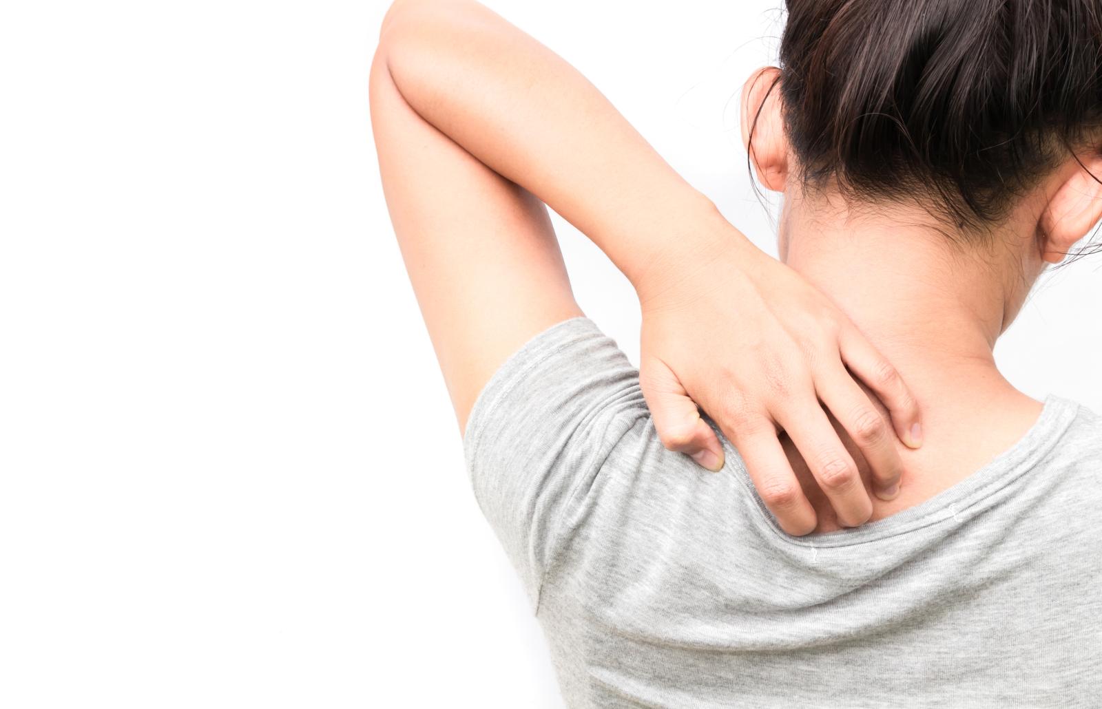 Ciri-Ciri Herpes Zoster Mulai Sembuh, Ini yang Harus Dilakukan