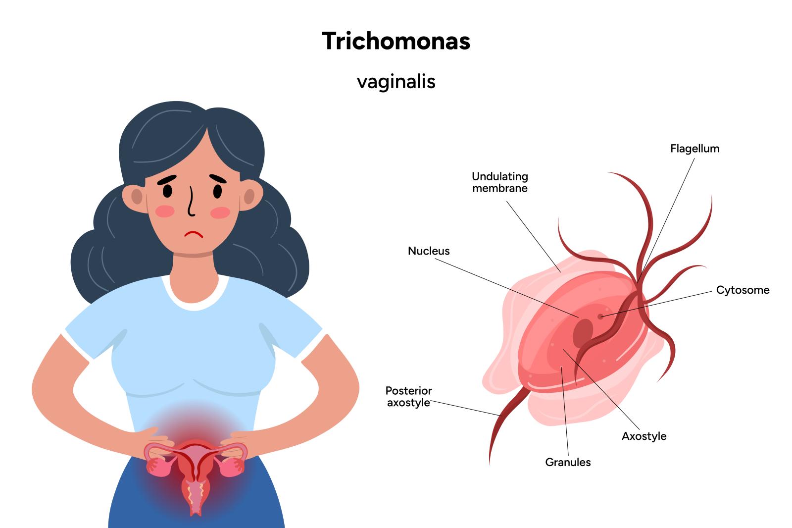 5 Rekomendasi Obat Trikomoniasis dan Dosisnya