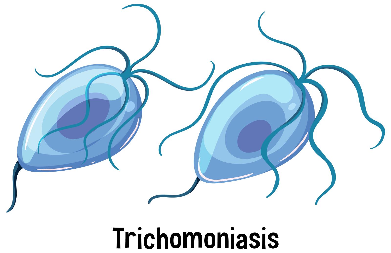 Ketahui 7 Cara Mencegah Trikomoniasis yang Efektif